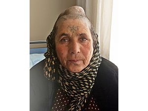Suriyeli Kadın Sığındığı Türkiyede Sağlığına Kavuştu