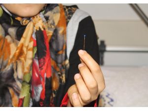 Nefes Borusundan Toplu İğne Çıkardılar