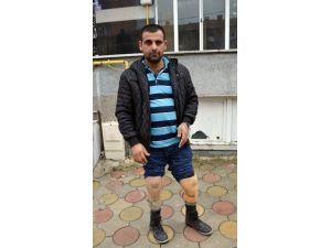 (Özel Haber) Protez Bacak İçin Yardım Bekliyor