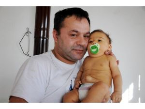 Çocuğunun Tedavisi İçin Gerekli 10 Bin Tl’lik Cihazı Sanayide Yaptırdı