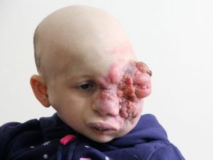 Minik Tuğsem’in Ailesi Yardım Bekliyor