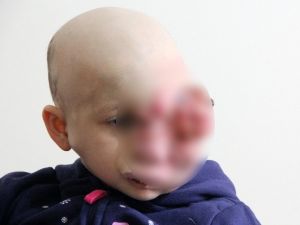 Minik Tuğsem’e İyi Haber !