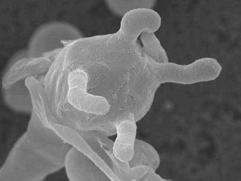 Ölümcül hastalık hızla yayılıyor