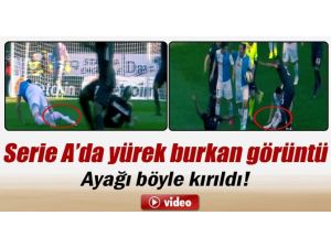 Ayağı Böyle Kırıldı !