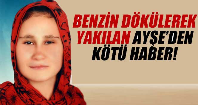 Ablası tarafından yakılan kız hayatını kaybetti