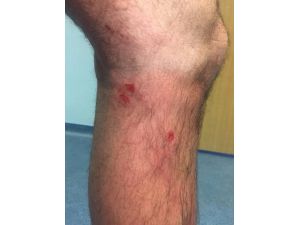 Fenerbahçe’den Sakatlık Açıklaması