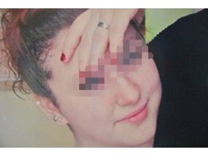 (Özel Haber) 16 Yaşındaki Kızının Hayatından Endişe Ediyor
