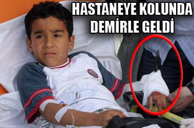 Demir korkulukla hastaneye geldi 