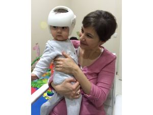 Bebeklerdeki Kafatası Şekil Bozukluklarına Dikkat