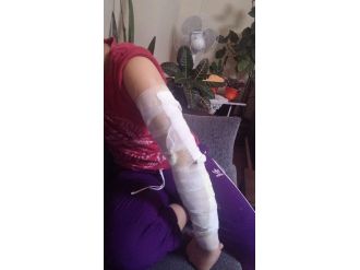 Edremit’te Hıdrelez Ateşi Genci Az Daha Yakıyordu