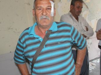 (Özel Haber) Bombalı Saldırıda Yaralanan Eski Başkan Yaşadıklarını Anlattı