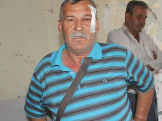 Hdp’ye Saldırıda Yaralanan Şahıs Olayı Anlattı