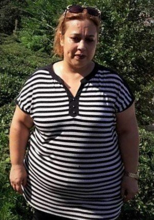 Gözlerinize inanamayacaksınız! 1 yılda 60 kilo verdi!