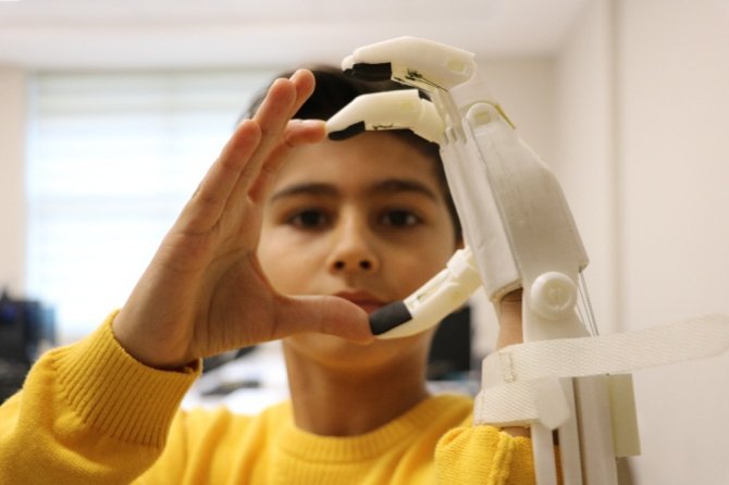 Doğuştan sol eli olmayan çocuk için "Robotel" tasarladı