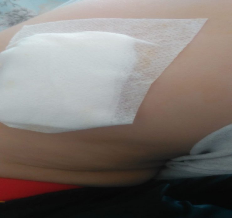 Köpek dehşeti: 9 yaşındaki çocuğa saldırdılar