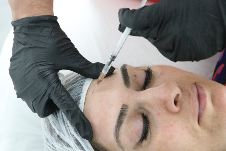 Botoks yaptırdı: Gözünden oluyordu