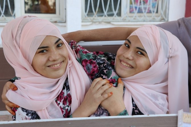 Siyam ikizlerinin üniversite hayali gerçek oluyor