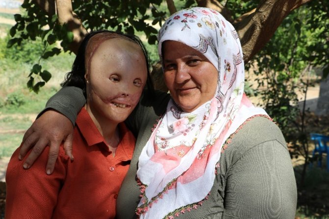 Kaahramanmaşlı Leyla’nın artık yüzü gülüyor