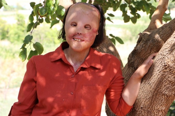 Kaahramanmaşlı Leyla’nın artık yüzü gülüyor