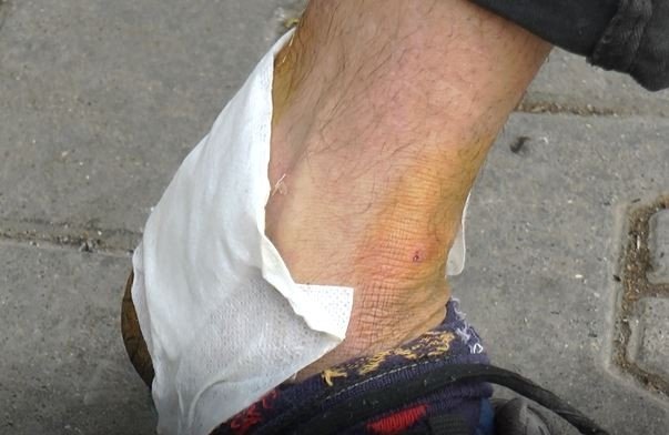 Gaziantep’te ikinci pitbull vakası